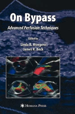 On Bypass: Advanced Perfusion Techniques by Mongero, Linda B.