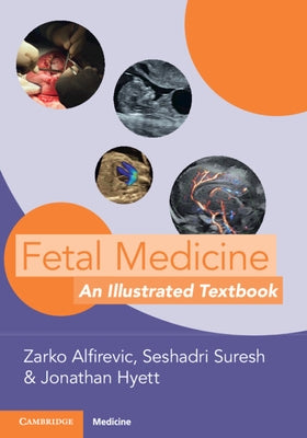 Fetal Medicine: An Illustrated Textbook by Alfirevic, Zarko