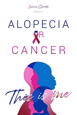 Alopecia or Cancer: This is Me by Hammond, Frances Lori