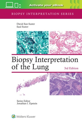 Biopsy Interpretation of the Lung: Print + eBook with Multimedia by Suster, David Ilan