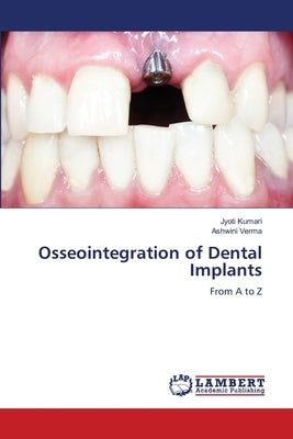 Osseointegration of Dental Implants by Kumari, Jyoti
