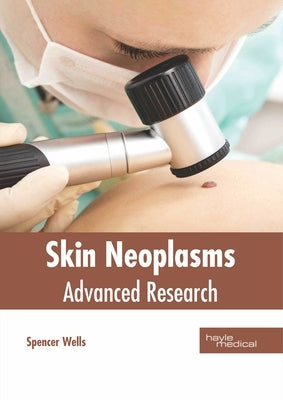 Skin Neoplasms: Advanced Research by Wells, Spencer
