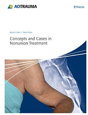 Concepts and Cases in Nonunion Treatment by Marti, René K.