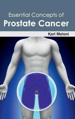Essential Concepts of Prostate Cancer by Meloni, Karl