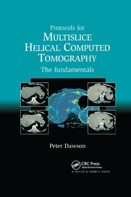 Protocols for Multislice Helical Computed Tomography: The Fundamentals by Peter, Dawson