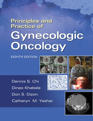 Principles and Practice of Gynecologic Oncology by Chi, Dennis