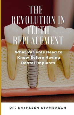 The Revolution in Teeth Replacement: What Patients Need to Know Before Having Dental Implants by Stambaugh, Kathleen