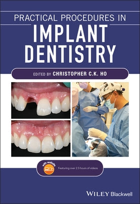 Practical Procedures in Implant Dentistry by Ho, Christopher C. K.