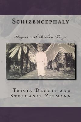Schizencephaly by Ziemann, Stephanie