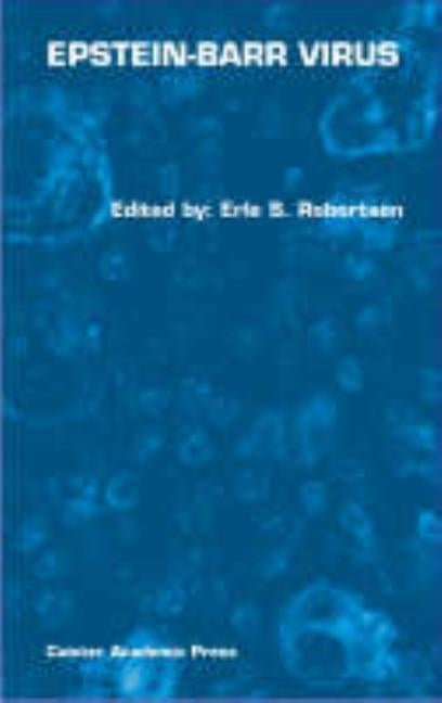 Epstein-Barr Virus by Robertson, Erle S.