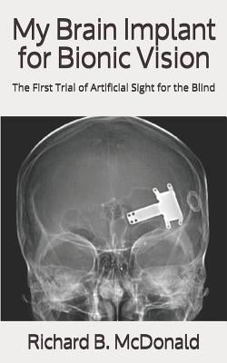 My Brain Implant for Bionic Vision: The First Trial of Artificial Sight for the Blind by McDonald, Richard B.