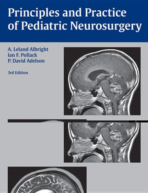 Principles and Practice of Pediatric Neurosurgery by Albright, A. Leland