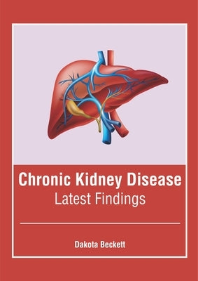 Chronic Kidney Disease: Latest Findings by Beckett, Dakota