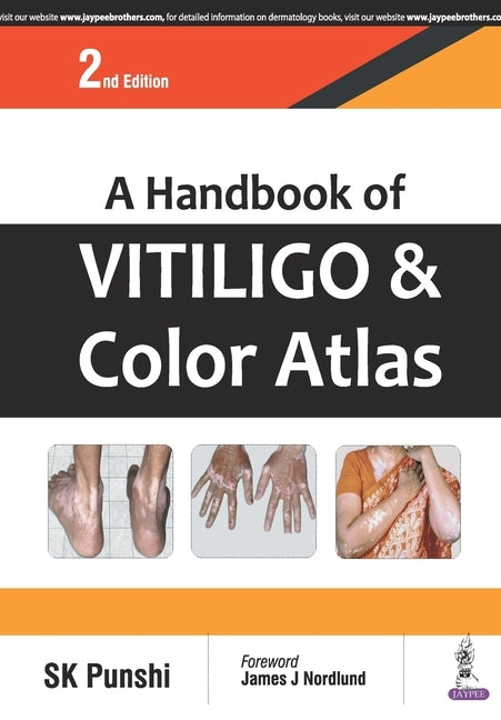 A Handbook of Vitiligo and Color Atlas by Punshi, Sk