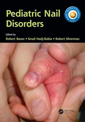 Pediatric Nail Disorders by Baran, Robert
