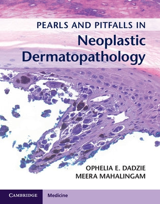 Pearls and Pitfalls in Neoplastic Dermatopathology with Online Access by Dadzie, Ophelia E.