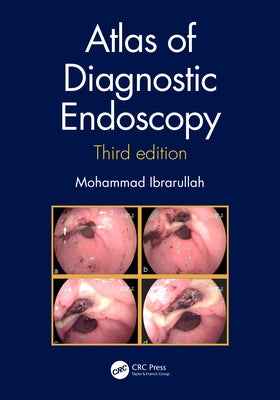 Atlas of Diagnostic Endoscopy, 3e by Ibrarullah, Mohammad