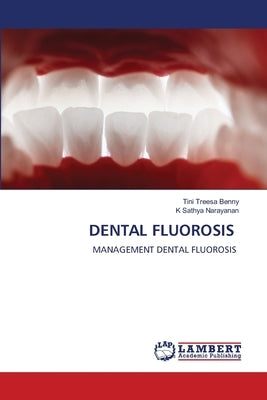 Dental Fluorosis by Benny, Tini Treesa