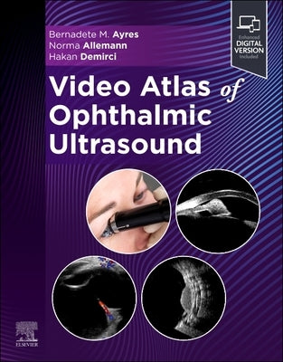 Video Atlas of Ophthalmic Ultrasound by Ayres, Bernadete