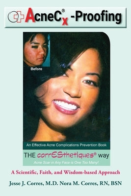 AcneC(R)X-Proofing: An Effective Acne Complications Prevention Book by Corres, Nora