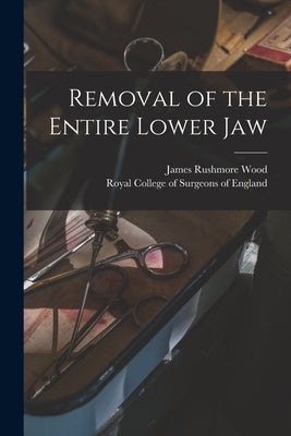 Removal of the Entire Lower Jaw by Wood, James Rushmore 1816-1882