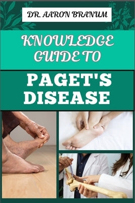 Knowledge Guide to Paget's Disease: Essential Manual To Symptoms, Diagnosis, Treatment Options, and Long-term Management by Branum, Aaron