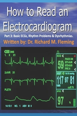 How to Read an Electrocardiogram - Part 3: Basic ECGs, Rhythm Problems & Dysrhythmias. by Fleming, Richard M.