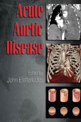 Acute Aortic Disease by Elefteriades, John