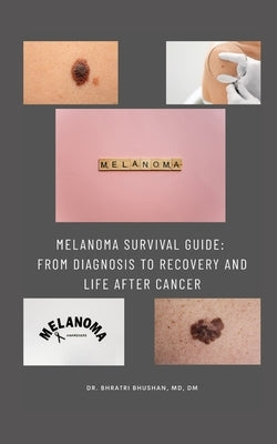 Melanoma Survival Guide: From Diagnosis to Recovery and Life After Cancer by Bhushan, Bhratri