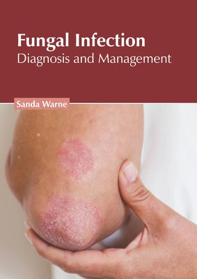 Fungal Infection: Diagnosis and Management by Warne, Sanda