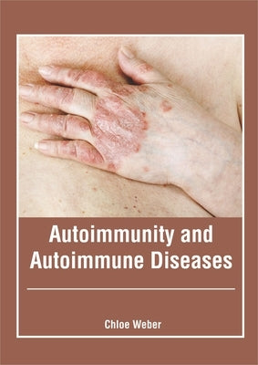 Autoimmunity and Autoimmune Diseases by Weber, Chloe
