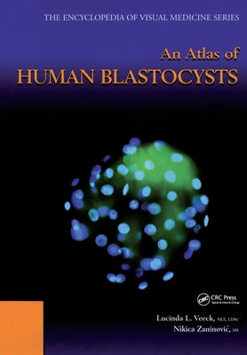 An Atlas of Human Blastocysts by Veeck, Lucinda L.