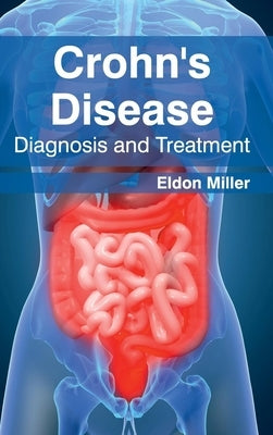 Crohn's Disease: Diagnosis and Treatment by Miller, Eldon