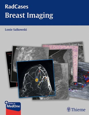 Radcases Breast Imaging by Salkowski, Lonie L.
