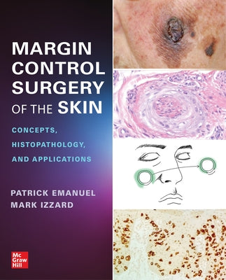 Margin Control Surgery of the Skin: Concepts, Histopathology, and Applications by Emanuel, Patrick