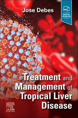 Treatment and Management of Tropical Liver Disease by Debes, Jose