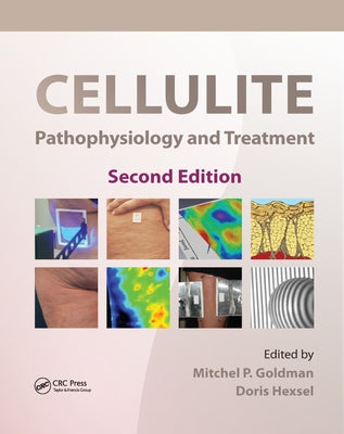 Cellulite: Pathophysiology and Treatment by Goldman, Mitchel P.