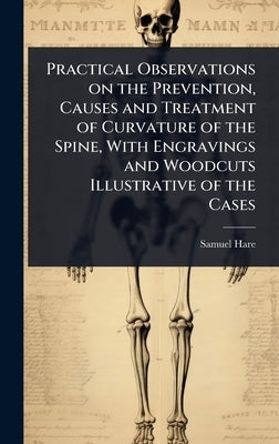 Practical Observations on the Prevention, Causes and Treatment of Curvature of the Spine, With Engravings and Woodcuts Illustrative of the Cases by Hare, Samuel