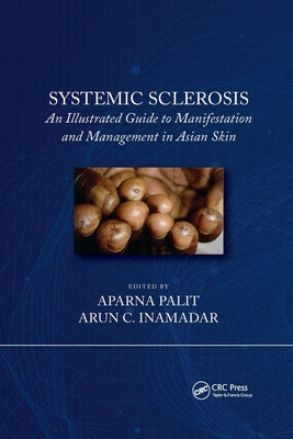 Systemic Sclerosis: An Illustrated Guide to Manifestation and Management in Asian Skin by Inamadar, Arun C.