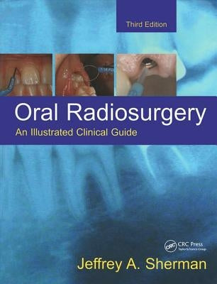 Oral Radiosurgery: An Illustrated Clinical Guide by Sherman, Jeffrey A.