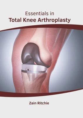 Essentials in Total Knee Arthroplasty by Ritchie, Zain