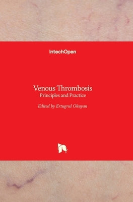 Venous Thrombosis: Principles and Practice by Okuyan, Ertugrul