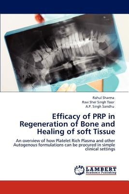 Efficacy of Prp in Regeneration of Bone and Healing of Soft Tissue by Sharma, Rahul