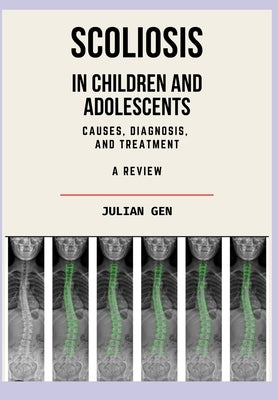 Scoliosis in Children and Adolescents by Gen, Julian
