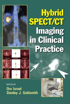 Hybrid SPECT/CT Imaging in Clinical Practice by Israel, Ora