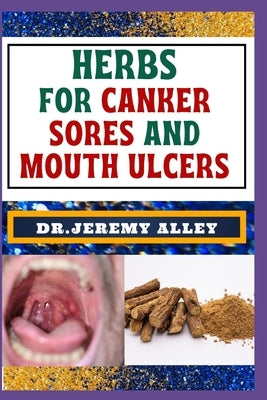 Herbs for Canker Sores and Mouth Ulcers: Soothing Remedies, Harnessing Wisdom To Relieve Nature's Bounty Through Effective Strategies by Alley, Jeremy