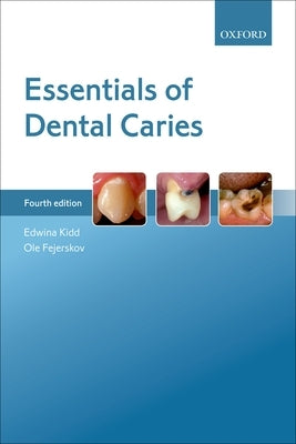 Essentials of Dental Caries by Kidd, Edwina