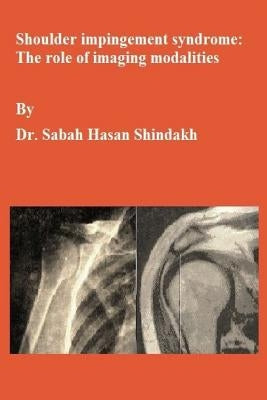 Shoulder impingement syndrome: The role of imaging modalities: Master thesis by Shindakh, Sabah Hasan
