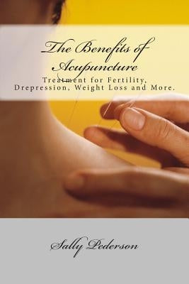 The Benefits of Acupuncture by Pederson, Sally