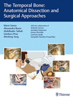 The Temporal Bone: Anatomical Dissection and Surgical Approaches by Sanna, Mario